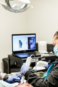 digital dental scanner